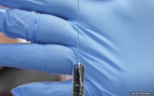 Phát hiện sớm ung thư bằng bọt biển